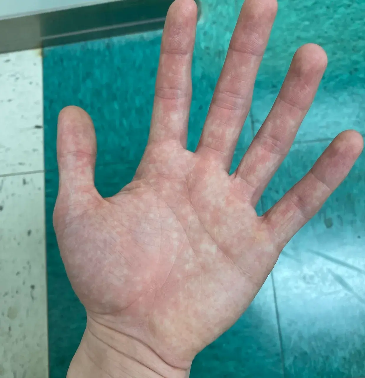 When I look at my hand while I’m tripping