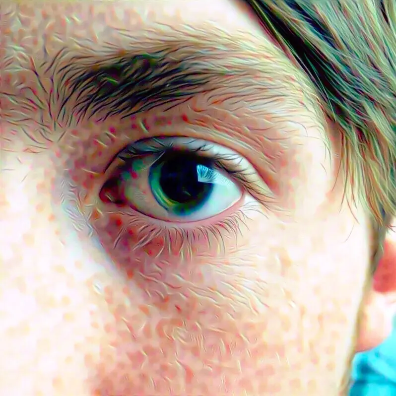 [LSD] Acid Face.