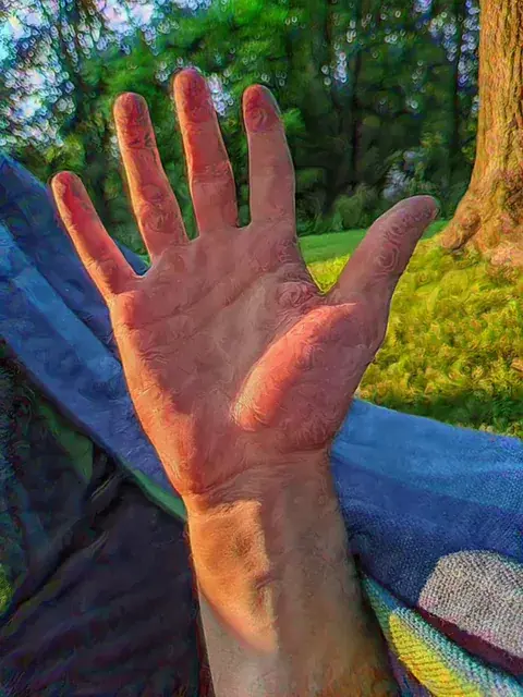 my hand on 250μg