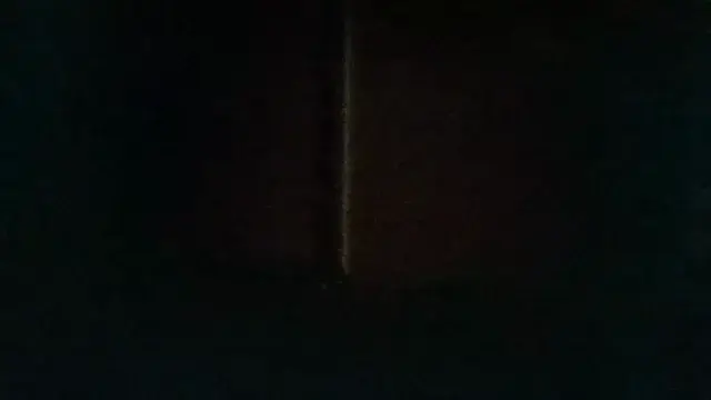 Amphetamine Psychosis