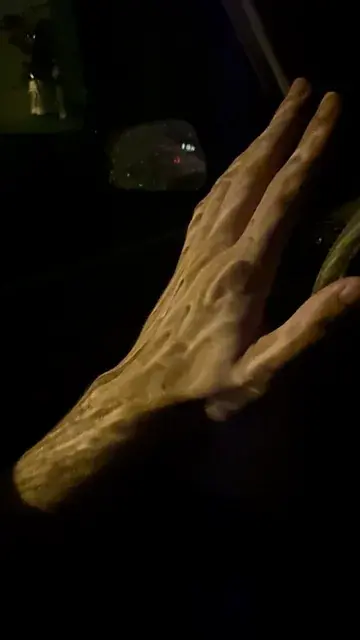 Melting hand