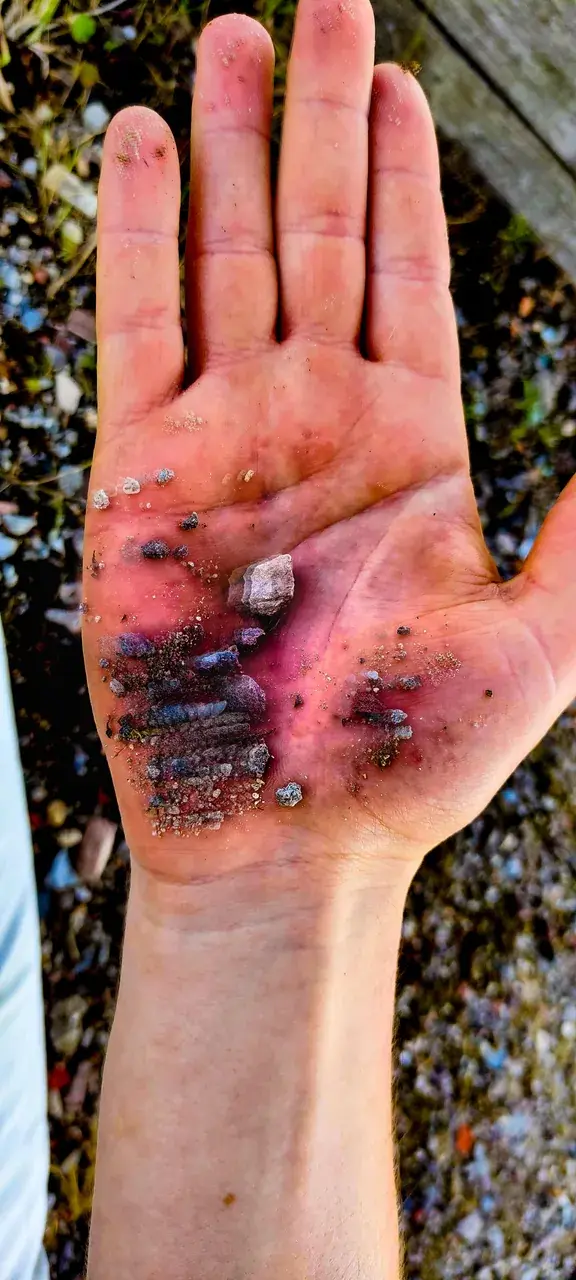 110 ug LSD first real trip. Put my hand in some gravel and saw something like this when I looked at it.