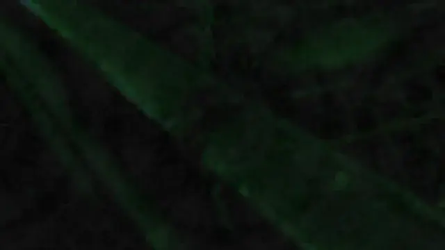 Subtle movement from HPPD and after images
