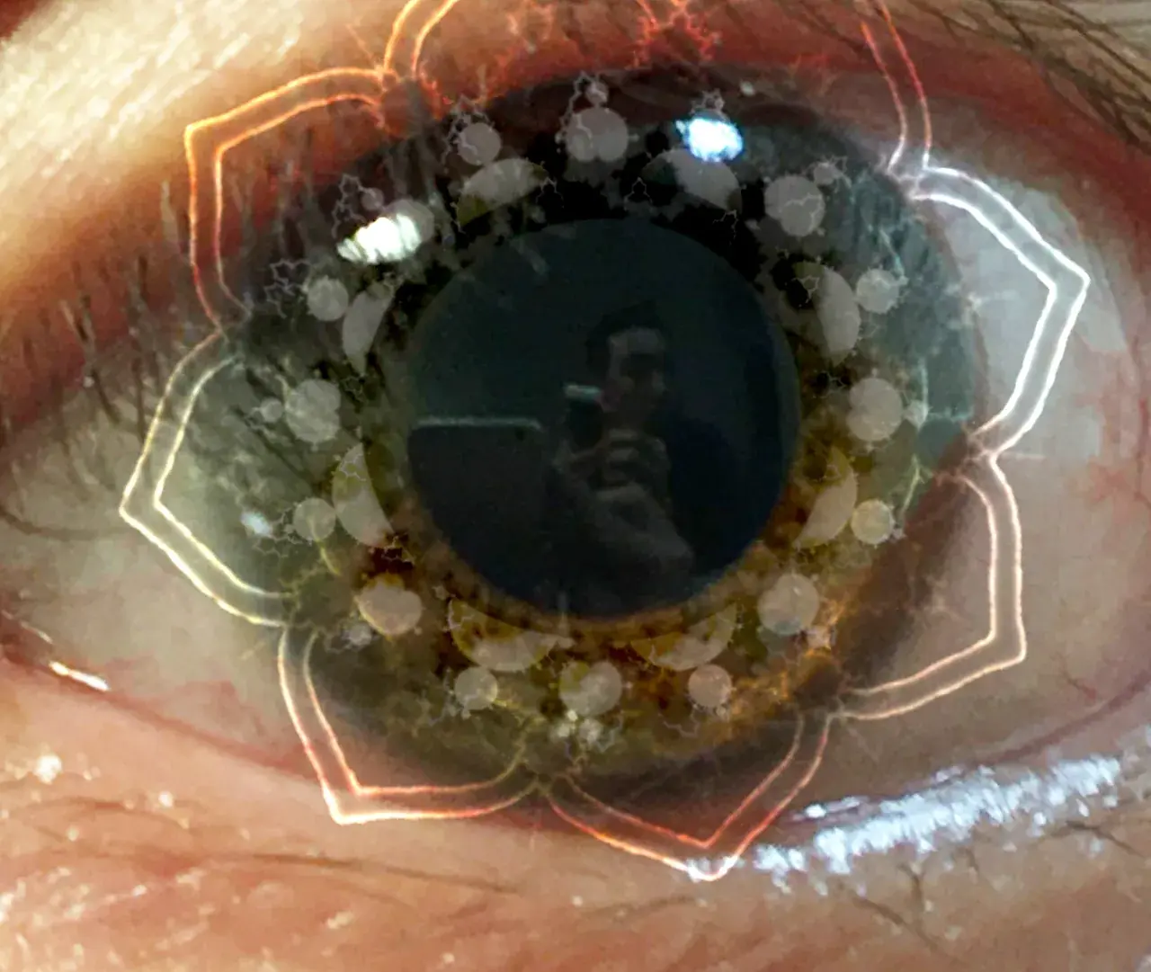 Pupil Dilation